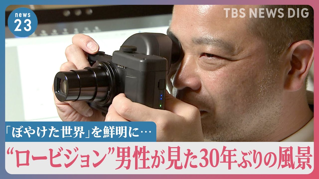 レーザー網膜投影カメラで「ぼやけた世界」を鮮明に…難病で視力低下の“ロービジョン”男性が見た30年ぶりの風景【news23】